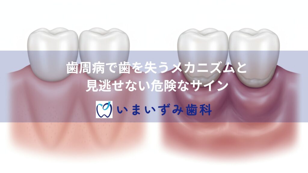 歯周病で歯を失うメカニズムと見逃せない危険なサイン