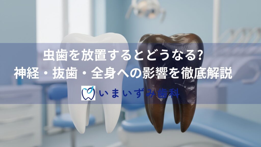 虫歯を放置するとどうなる?神経・抜歯・全身への影響を徹底解説